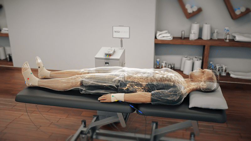 NESA neuromodulation